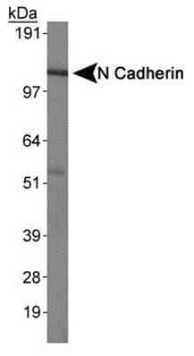 Western Blot: N-Cadherin Antibody (13A9) [NBP1-48309]