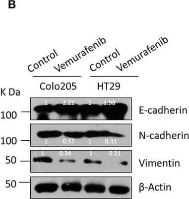 Western Blot: N-Cadherin Antibody (13A9) [NBP1-48309]