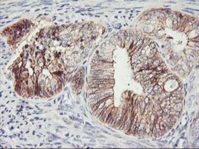 Immunohistochemistry-Paraffin: N-Cadherin Antibody (OTI2G7) [NBP2-01498]