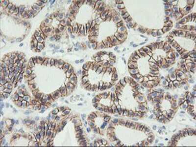 Immunohistochemistry-Paraffin: N-Cadherin Antibody (OTI2G7) [NBP2-01498]
