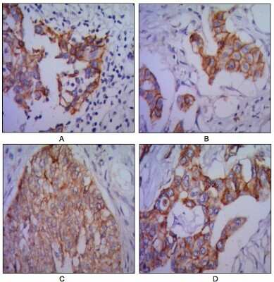 Immunohistochemistry-Paraffin: N-Cadherin Antibody (5D5) - BSA Free [NBP1-51612]