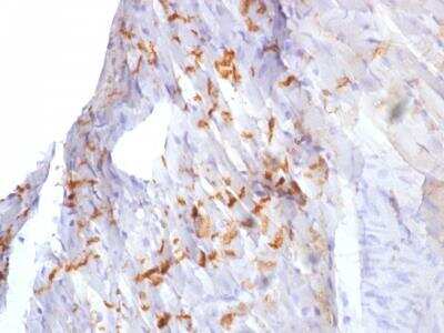 Immunohistochemistry-Paraffin: N-Cadherin Antibody (8C11) [NBP2-53321]