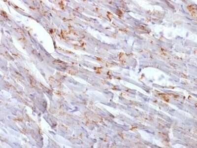 Immunohistochemistry-Paraffin: N-Cadherin Antibody (CDH2/1573) [NBP2-53328]