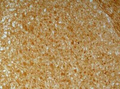 Immunohistochemistry-Frozen: N-Cadherin Antibody [NBP2-19457]