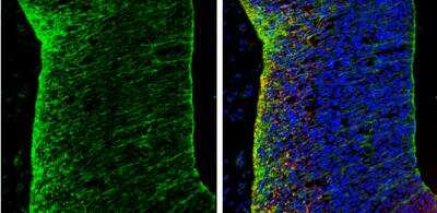 Immunohistochemistry-Frozen: N-Cadherin Antibody [NBP2-19457]