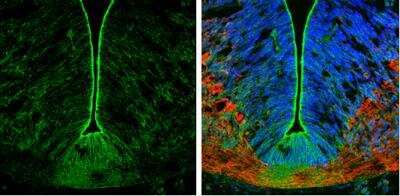 Immunohistochemistry-Frozen: N-Cadherin Antibody [NBP2-19460]