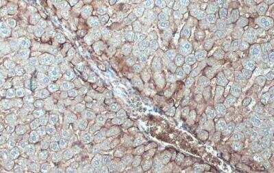 Immunohistochemistry-Paraffin: N-Cadherin Antibody [NBP2-19457]