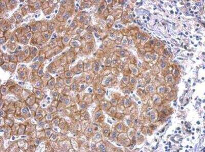 Immunohistochemistry-Paraffin: N-Cadherin Antibody [NBP2-19459]