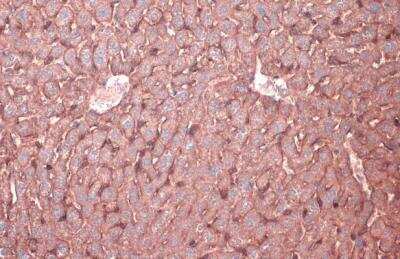 Immunohistochemistry-Paraffin: N-Cadherin Antibody [NBP2-19459]