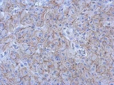 Immunohistochemistry-Paraffin: N-Cadherin Antibody [NBP2-19460]