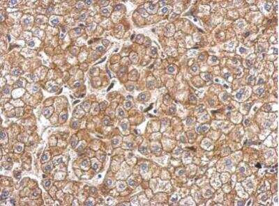 Immunohistochemistry-Paraffin: N-Cadherin Antibody [NBP2-19460]