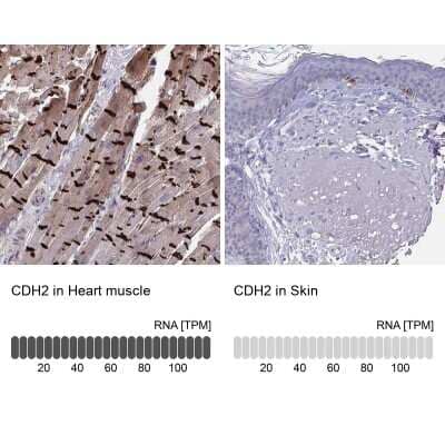 Immunohistochemistry-Paraffin: N-Cadherin Antibody [NBP2-38856]