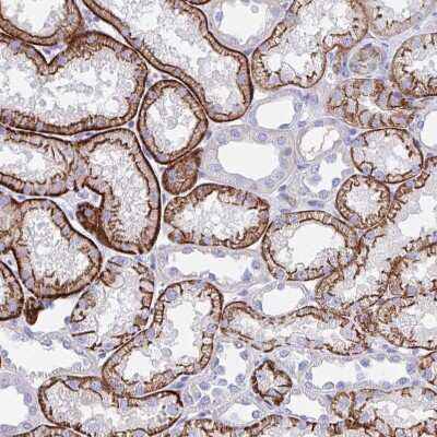 Immunohistochemistry-Paraffin: N-Cadherin Antibody [NBP2-38856]