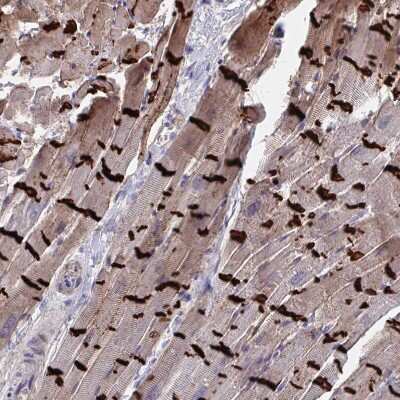 Immunohistochemistry-Paraffin: N-Cadherin Antibody [NBP2-38856]