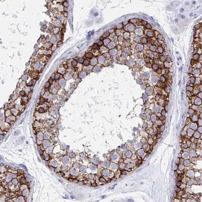 Immunohistochemistry-Paraffin: N-Cadherin Antibody [NBP2-38856]