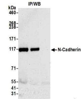 Immunoprecipitation: N-Cadherin Antibody (BLR097G) [NBP3-14690]