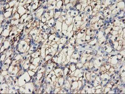 Immunohistochemistry: N-Cadherin Antibody (OTI2G7) - Azide and BSA Free [NBP2-72891]