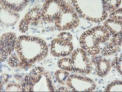 Immunohistochemistry: N-Cadherin Antibody (OTI2G7) - Azide and BSA Free [NBP2-72891]