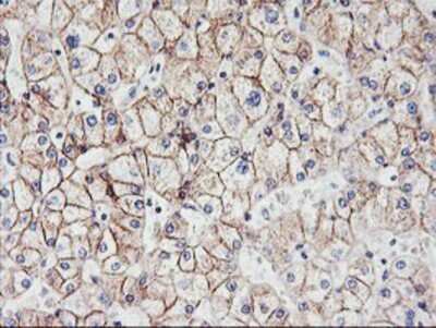 Immunohistochemistry: N-Cadherin Antibody (OTI2G7) - Azide and BSA Free [NBP2-72891]