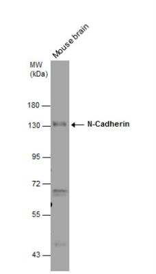 Western Blot: N-Cadherin Antibody [NBP2-19460]