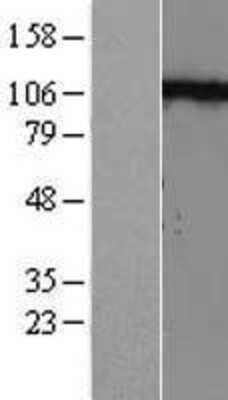 Western Blot: N-Cadherin Overexpression Lysate [NBL1-09030]