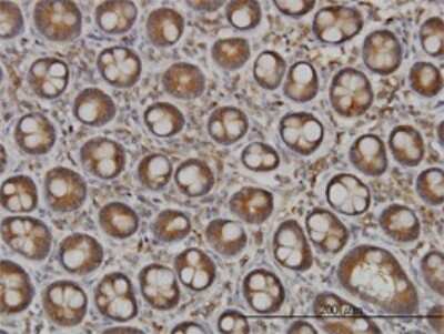 Immunohistochemistry-Paraffin: N-Deacetylase/N-Sulfotransferase 1/NDST1 Antibody (1G10) [H00003340-M01]