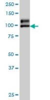 Western Blot: N-Deacetylase/N-Sulfotransferase 1/NDST1 Antibody (1G10) [H00003340-M01]