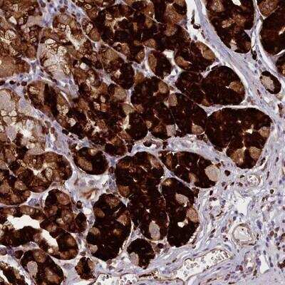 Immunohistochemistry-Paraffin: N-Deacetylase/N-Sulfotransferase 2/NDST2 Antibody [NBP2-13645]