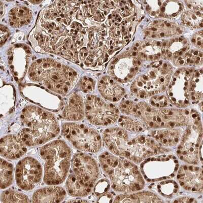 Immunohistochemistry: N-PAC Antibody [NBP2-38618]