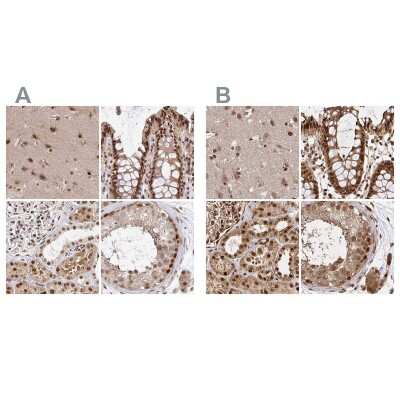 Immunohistochemistry-Paraffin: N-PAC Antibody [NBP2-38576]