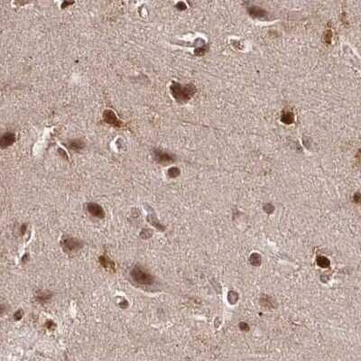 Immunohistochemistry-Paraffin: N-PAC Antibody [NBP2-38576]