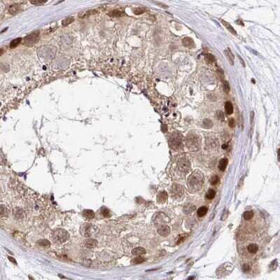Immunohistochemistry-Paraffin: N-PAC Antibody [NBP2-38576]