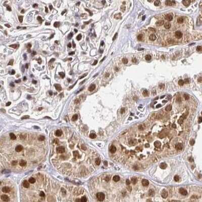 Immunohistochemistry-Paraffin: N-PAC Antibody [NBP2-38576]