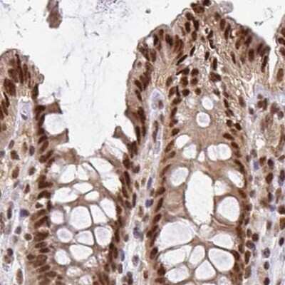 Immunohistochemistry-Paraffin: N-PAC Antibody [NBP2-38576]