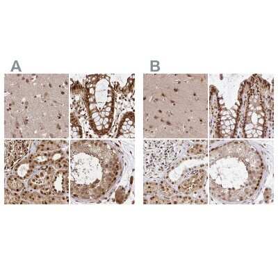 Immunohistochemistry-Paraffin: N-PAC Antibody [NBP2-38618]