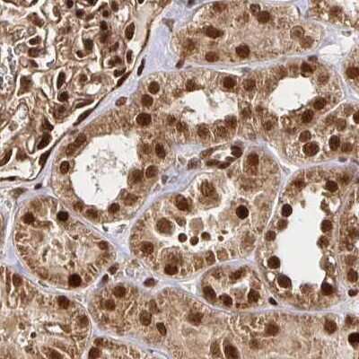 Immunohistochemistry-Paraffin: N-PAC Antibody [NBP2-38618]