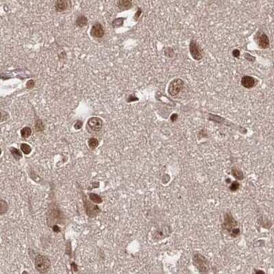 Immunohistochemistry-Paraffin: N-PAC Antibody [NBP2-38618]