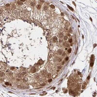 Immunohistochemistry-Paraffin: N-PAC Antibody [NBP2-38618]