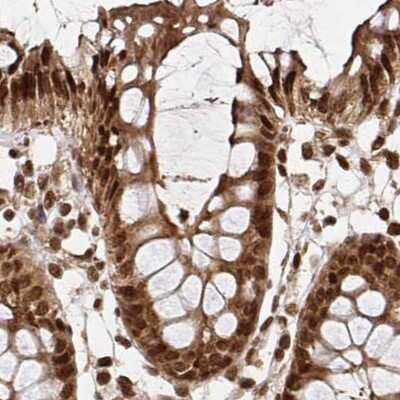 Immunohistochemistry-Paraffin: N-PAC Antibody [NBP2-38618]