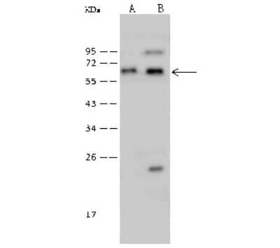 Western Blot: N-PAC Antibody [NBP2-99354]