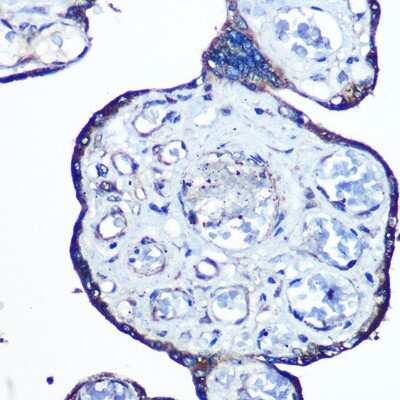 Immunohistochemistry-Paraffin: N-WASP Antibody (4P5M9) [NBP3-16103]