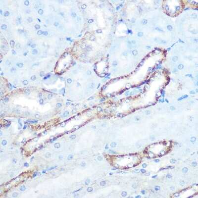 Immunohistochemistry-Paraffin: N-WASP Antibody (4P5M9) [NBP3-16103]
