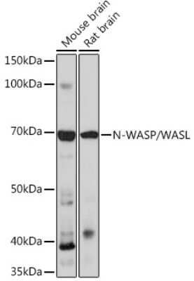 Western Blot: N-WASP Antibody (4P5M9) [NBP3-16103]