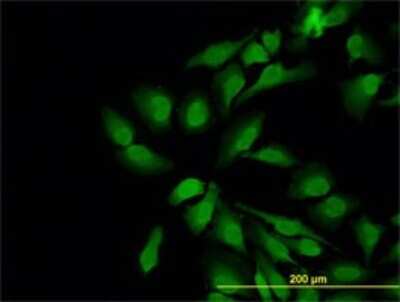 Immunocytochemistry/ Immunofluorescence: N-WASP Antibody (5F4) [H00008976-M04]