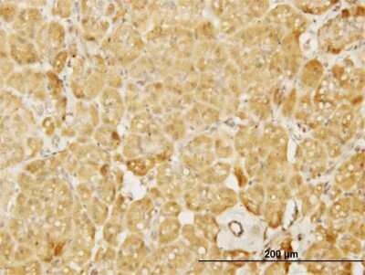 Immunohistochemistry-Paraffin: N-WASP Antibody (5F4) [H00008976-M04]