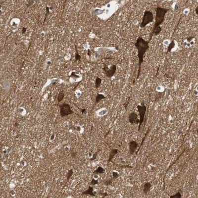 Immunohistochemistry-Paraffin: N-WASP Antibody [NBP1-82512]