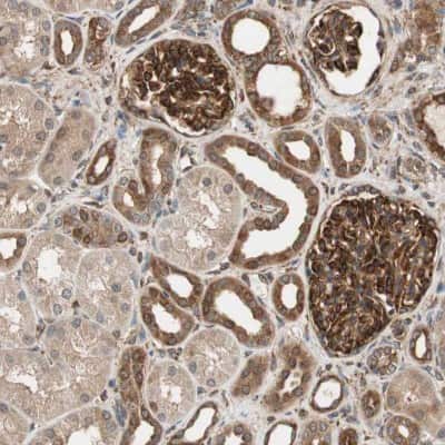 Immunohistochemistry-Paraffin: N-WASP Antibody [NBP1-82512]