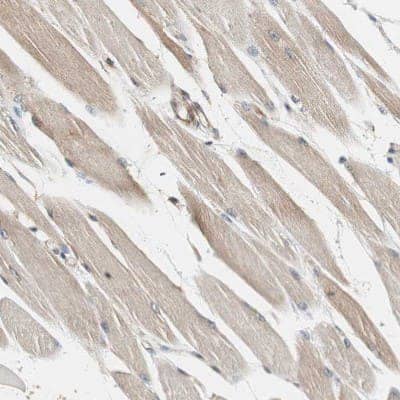 Immunohistochemistry-Paraffin: N-WASP Antibody [NBP1-82512]