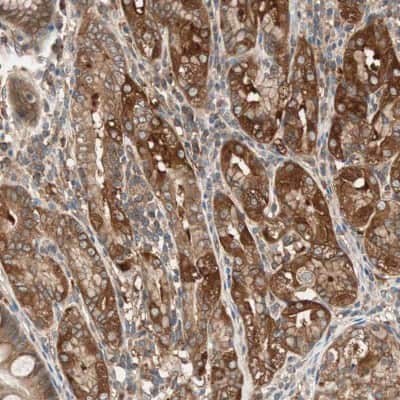 Immunohistochemistry-Paraffin: N-WASP Antibody [NBP1-82512]