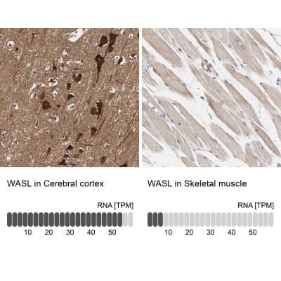 Immunohistochemistry-Paraffin: N-WASP Antibody [NBP1-82512]